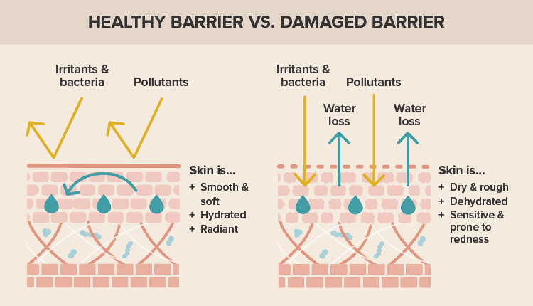 Una barrera sana vs. una barrera dañada